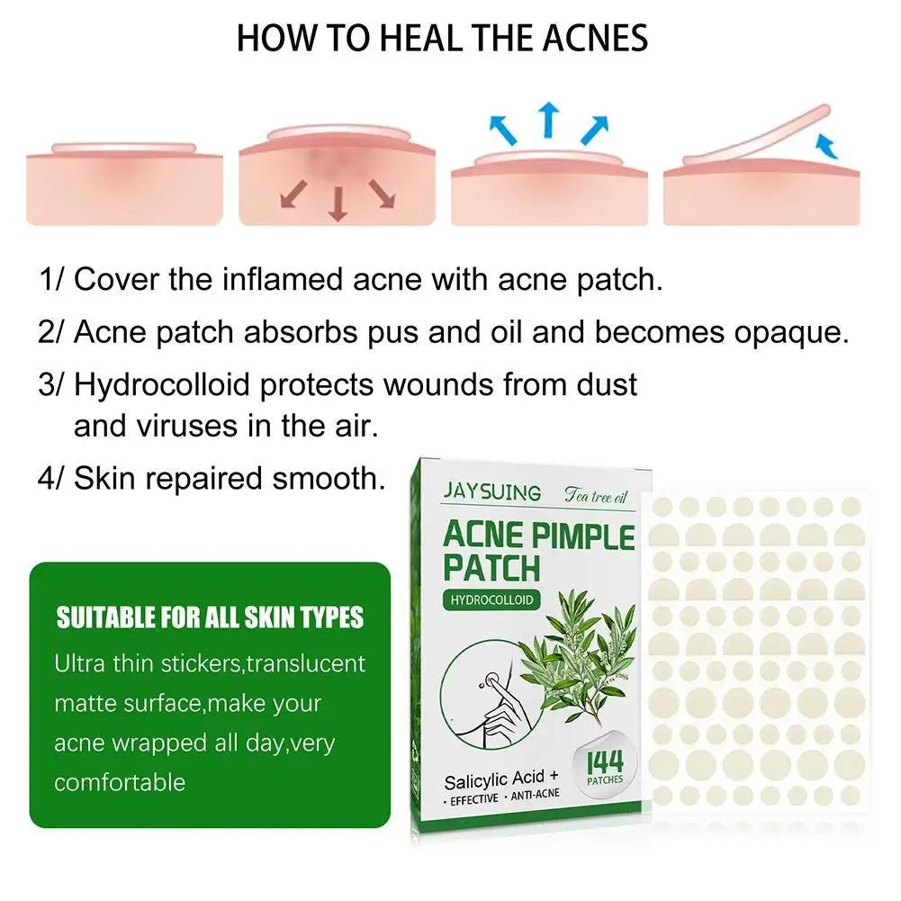 Tea Tree Oil Acne Pimple Patch - Waterproof Blemish Treatment (144 pcs).