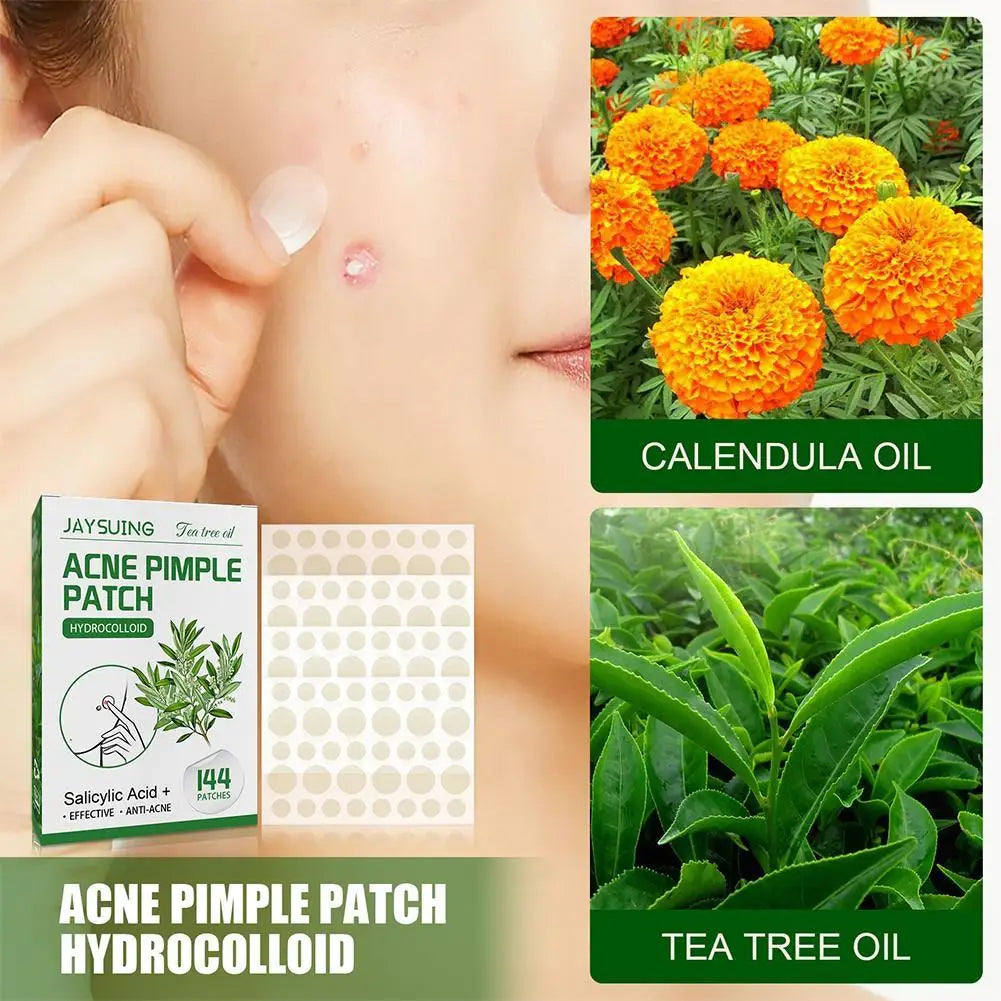 Tea Tree Oil Acne Pimple Patch - Waterproof Blemish Treatment (144 pcs).