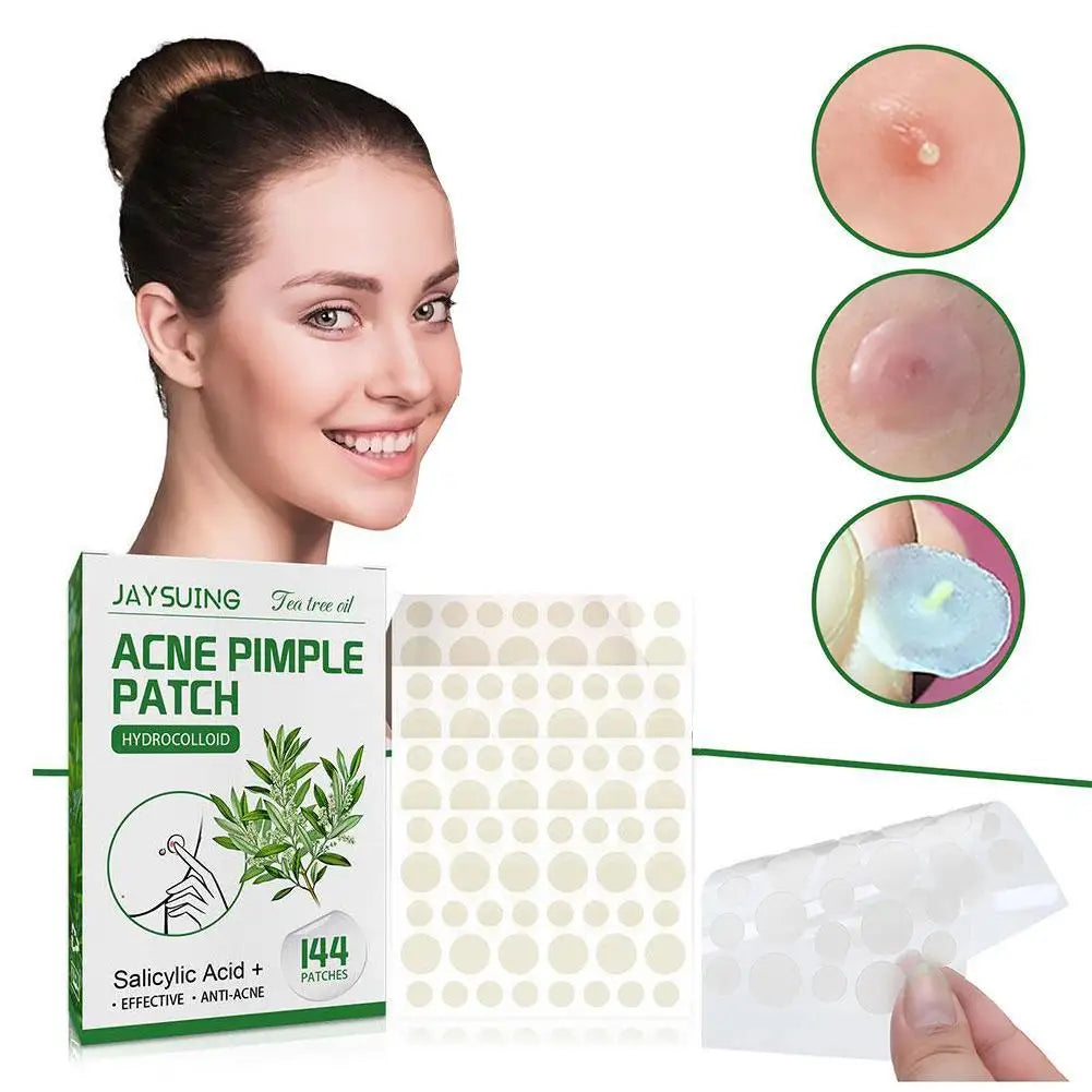 Tea Tree Oil Acne Pimple Patch - Waterproof Blemish Treatment (144 pcs).