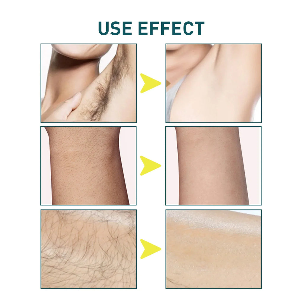 Professional Hair Removal Wax Strips – Face & Body.