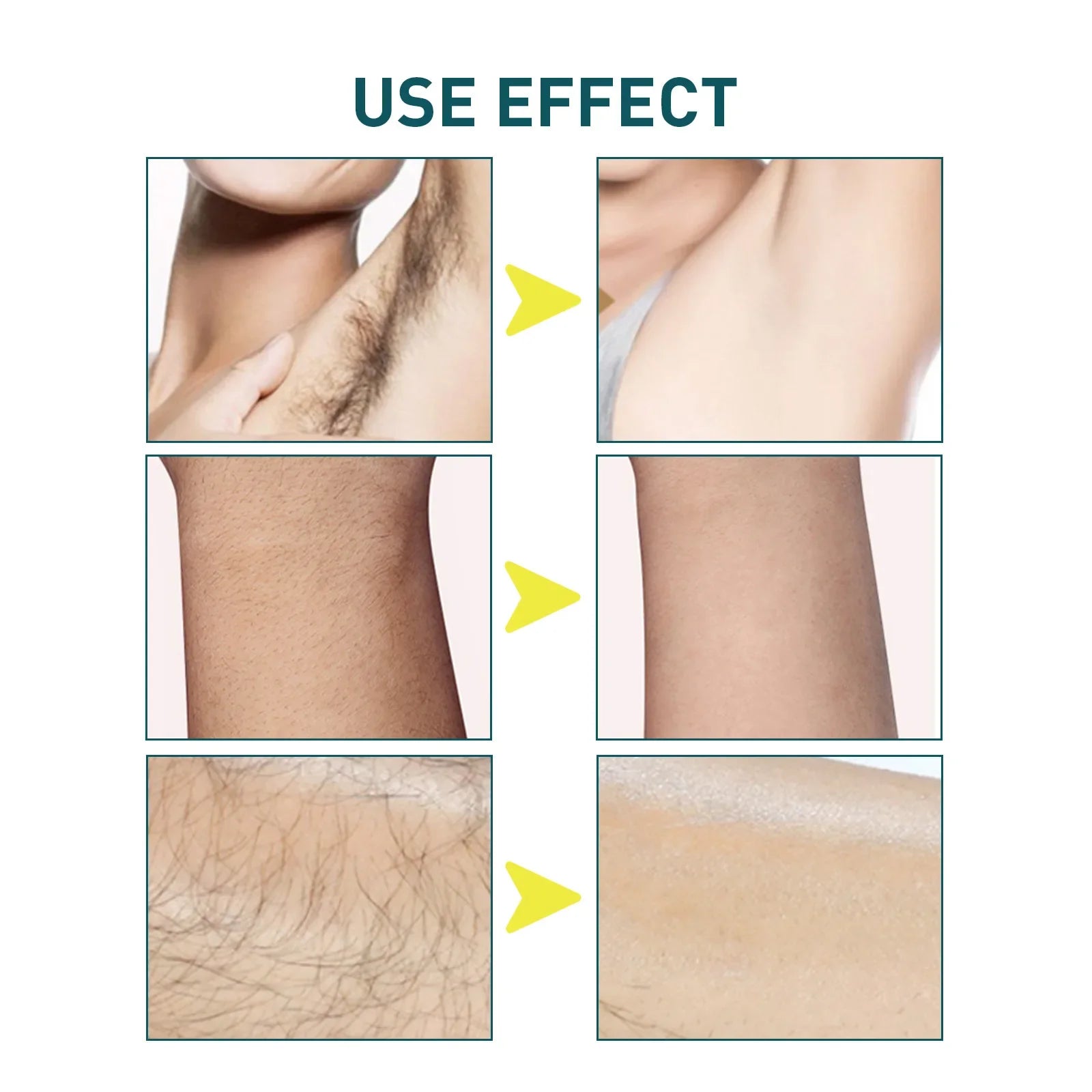 Professional Hair Removal Wax Strips – Face & Body.