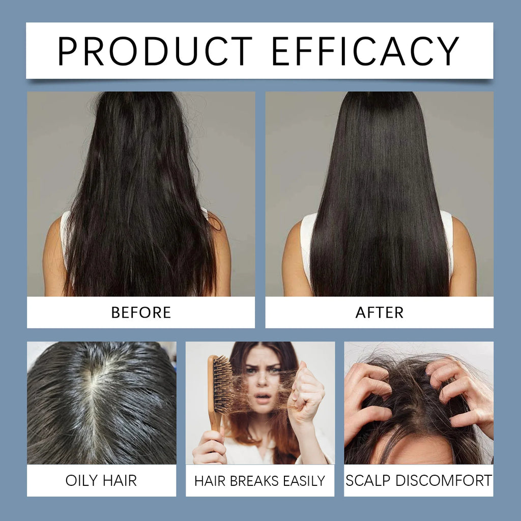Hoegoa Rosemary Hair Growth Roll-On Essence