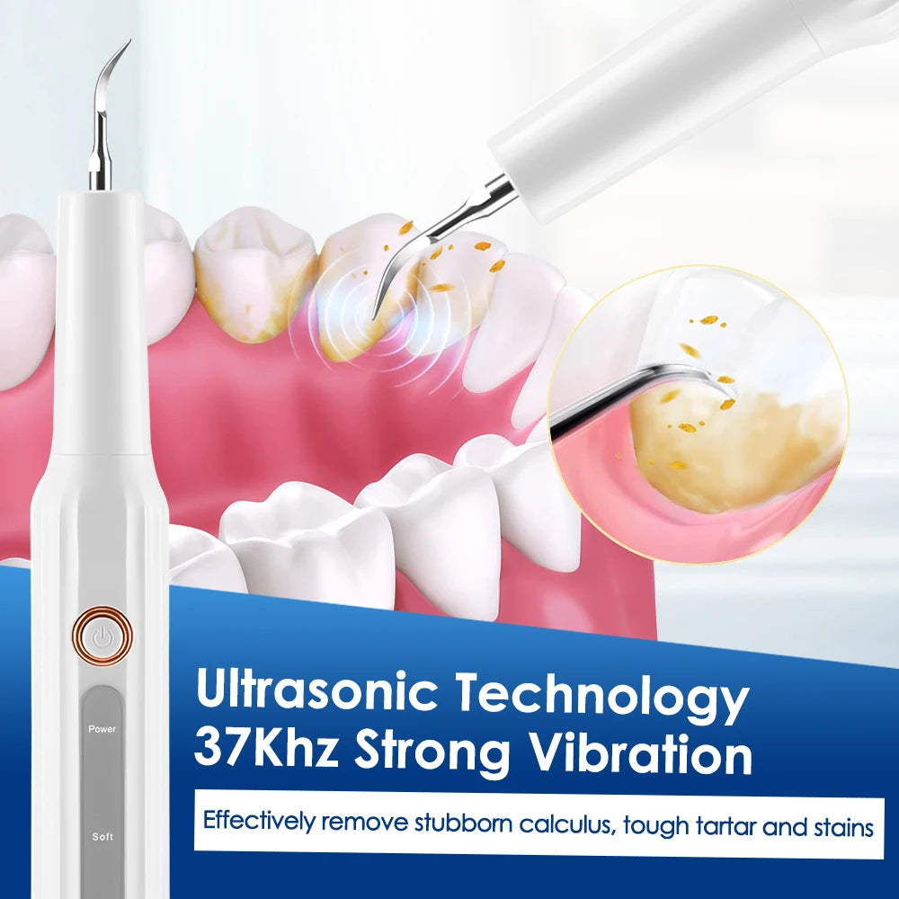 Ultrasonic Tooth Cleaner & Dental Calculus Remover