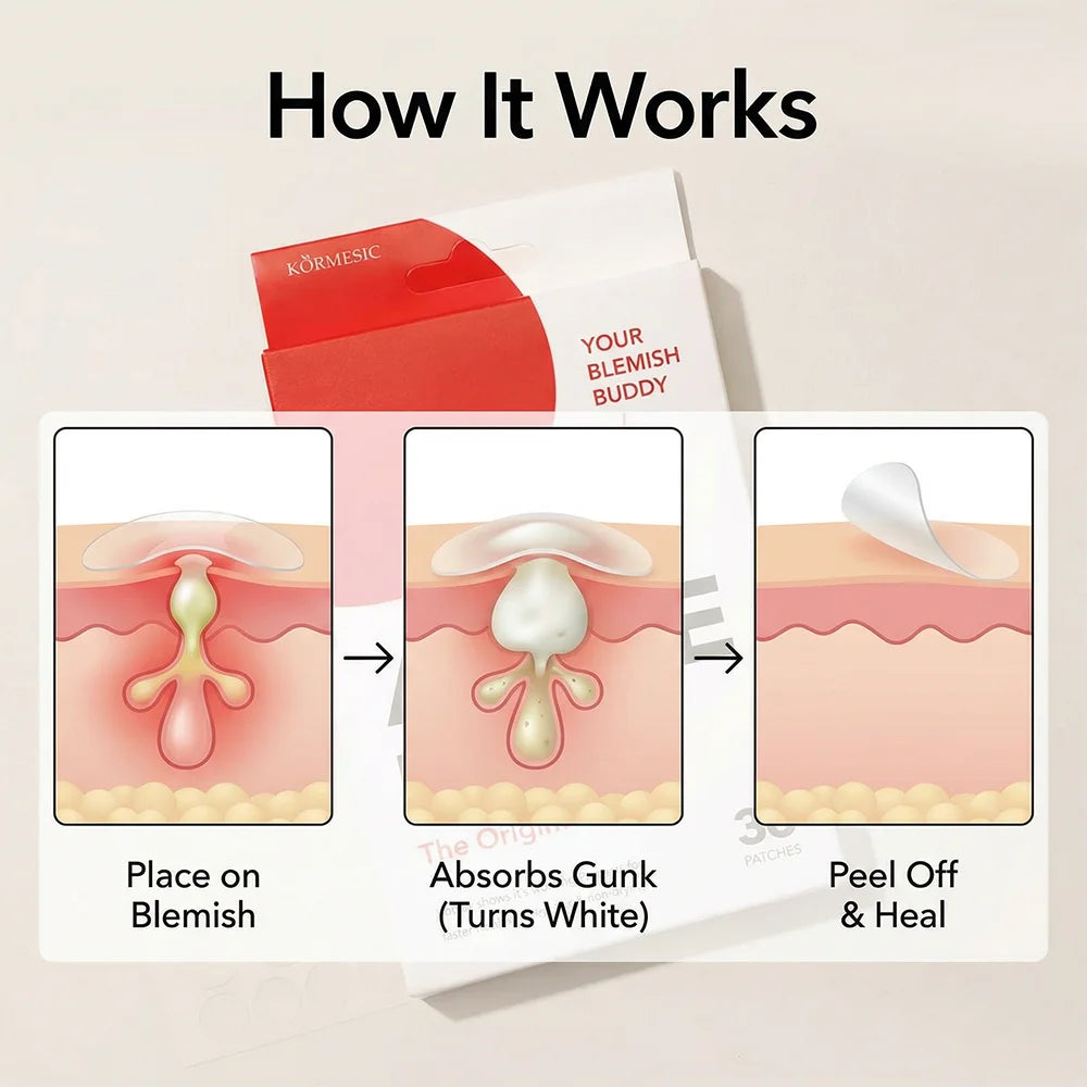 Invisible Acne Pimple Patches - 36pc Hydrocolloid Healing Stickers