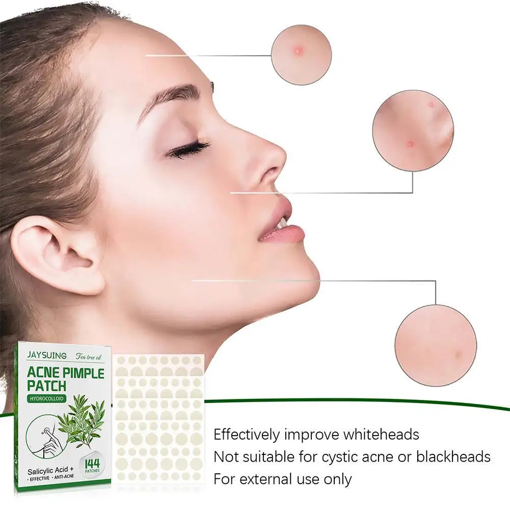 Tea Tree Oil Acne Pimple Patch - Waterproof Blemish Treatment (144 pcs).