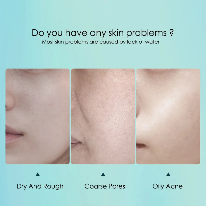 10-Pcs Hyaluronic Acid Hydrating Facial Sheet Mask Set