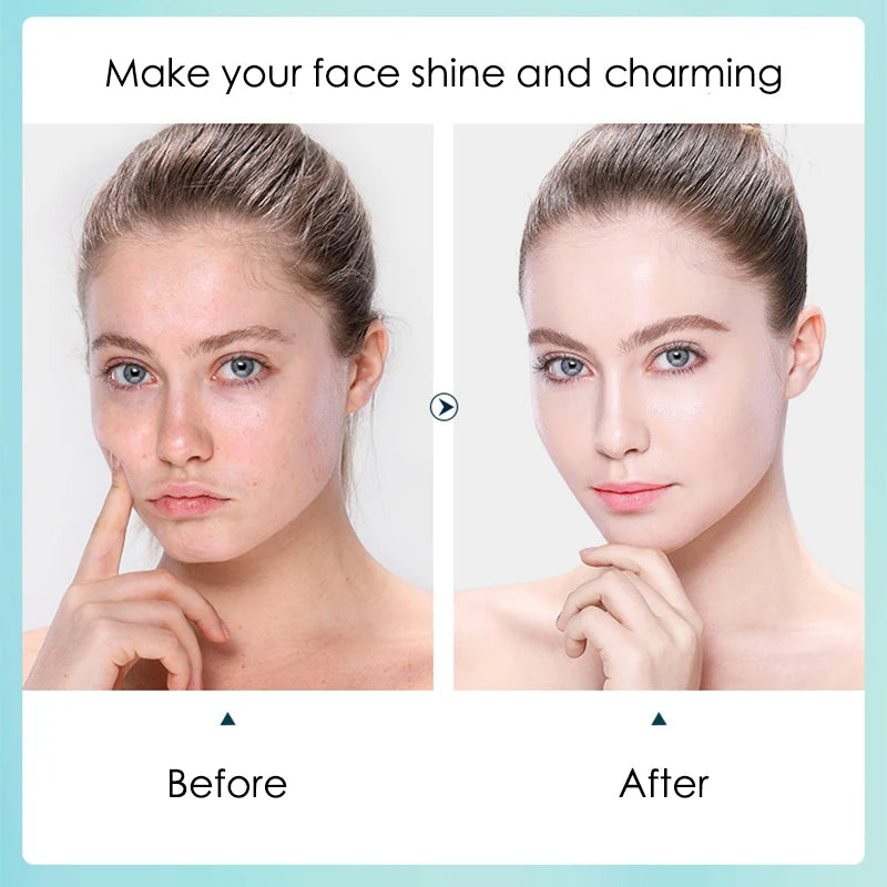 10-Pcs Hyaluronic Acid Hydrating Facial Sheet Mask Set