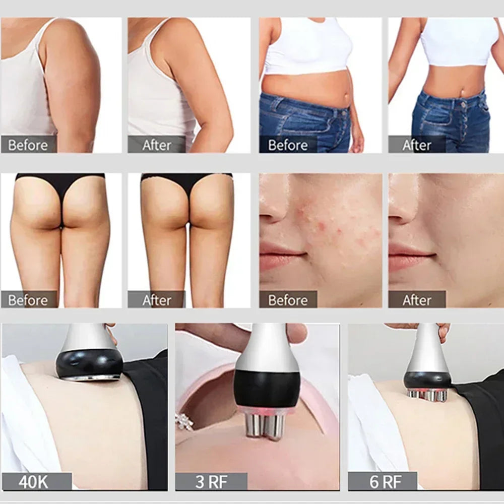 Professional 40K Ultrasonic Cavitation & RF Body Sculpting Machine - Home Beauty Spa for Skin Tightening & Weight Loss