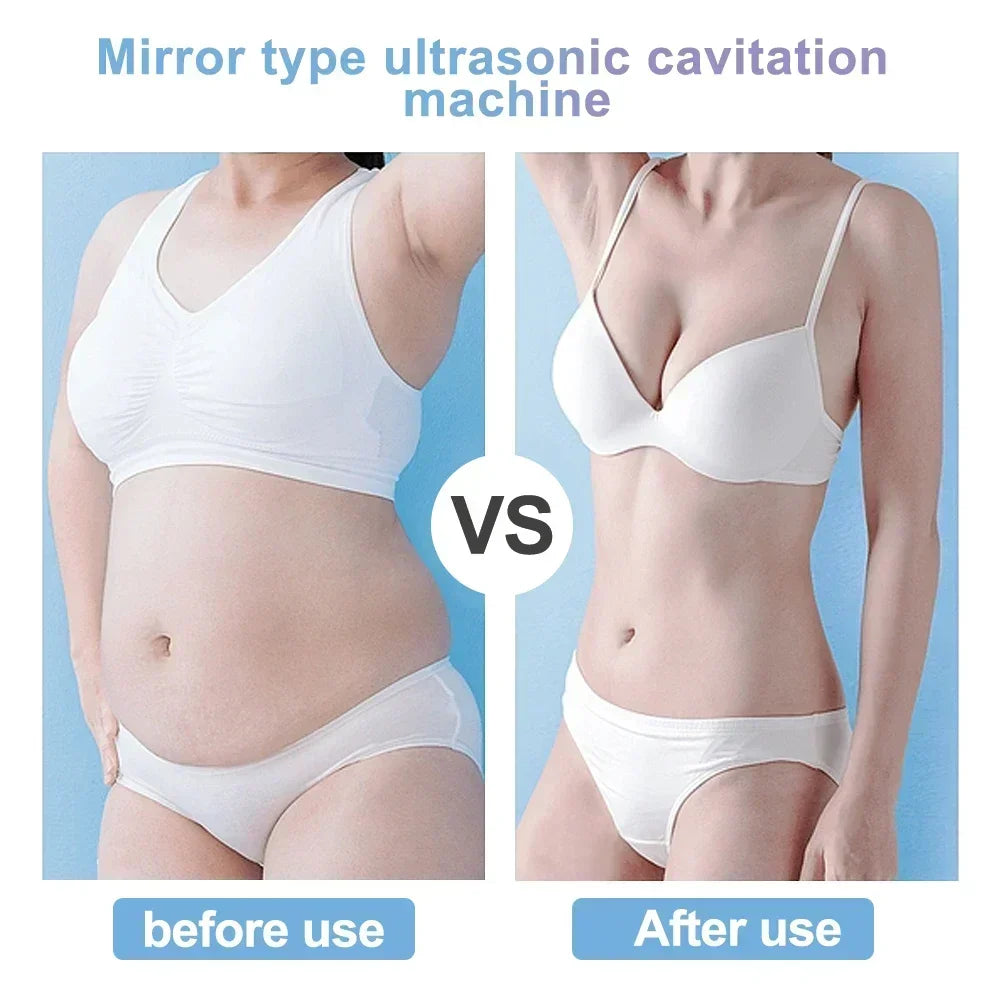 Professional 40K Ultrasonic Cavitation & RF Body Sculpting Machine - Home Beauty Spa for Skin Tightening & Weight Loss