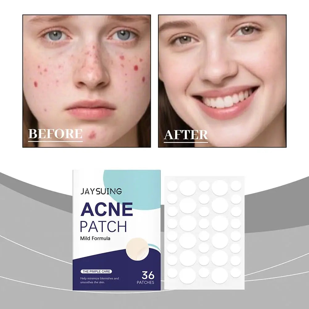 Extra Thin Invisible Acne Patches - 36pc Hydrocolloid Blemish Stickers