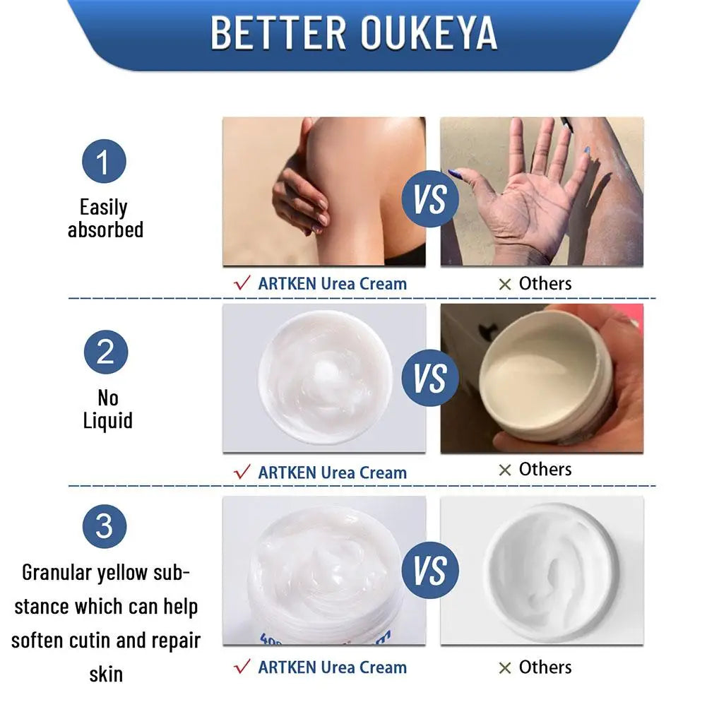 40% Urea Cream with Vitamin E - Intensive Moisturizing Foot & Hand Cream